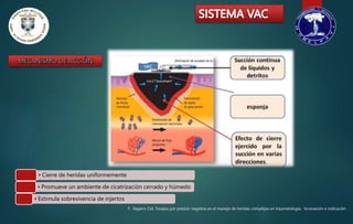 sistema vac 1.pptx