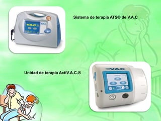 Sistema de terapia ATS® de V.A.C
Unidad de terapia ActiV.A.C.®
 
