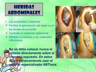 HERIDAS
ABDOMINALES
• Los propósitos y objetivos:
 Facilitar la granulación del tejido y unir
los bordes de la herida
 Controlar el contenido abdominal
 Eliminar el exudado y los materiales
infecciosos.
• No se debe colocar nunca el
apósito directamente sobre el
intestino expuesto. En estos
casos se recomienda usar el
apósito especializado ABThera.
 