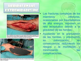 • Las fracturas complejas de los
miembros inferiores,
ocasionadas por traumatismos
de alta energía, suponen un
reto terapéutico debido a la
gravedad de las heridas.
• Ayudando en la granulación
de las heridas, y previniendo
su colonización; en
consecuencia, reduciendo los
riesgos y la morbilidad, y
minimizando las
complicaciones.
 