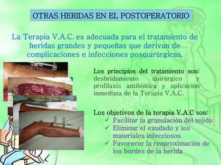 Los objetivos de la terapia V.A.C son:
 Facilitar la granulación del tejido
 Eliminar el exudado y los
materiales infecciosos
 Favorecer la reaproximación de
los bordes de la herida
OTRAS HERIDAS EN EL POSTOPERATORIO
La Terapia V.A.C. es adecuada para el tratamiento de
heridas grandes y pequeñas que derivan de
complicaciones e infecciones posquirúrgicas.
Los principios del tratamiento son:
desbridamiento quirúrgico y
profilaxis antibiótica y aplicación
inmediata de la Terapia V.A.C.
 