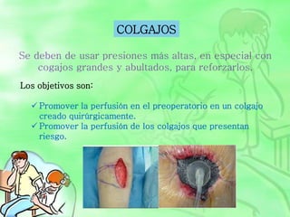 Los objetivos son:
 Promover la perfusión en el preoperatorio en un colgajo
creado quirúrgicamente.
 Promover la perfusión de los colgajos que presentan
riesgo.
COLGAJOS
Se deben de usar presiones más altas, en especial con
cogajos grandes y abultados, para reforzarlos.
 