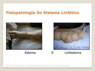 Fisiopatologia Do Sistema Linfático




                           Edema                                X                  Linfedema


Maria Teresa Castilho Sousa - 10ª Acção de Técnicas de Esteticismo e Cosmetologia 2010/2011
 