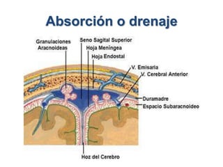 Absorción o drenaje