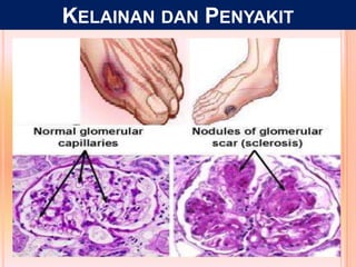 KELAINAN DAN PENYAKIT
 