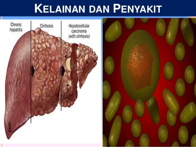 Sistem Ekskresi Pada Manusia