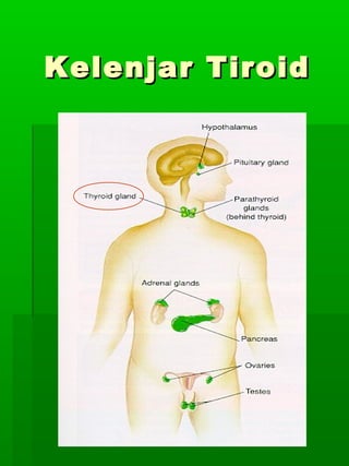 Kelenjar Tiroid
 