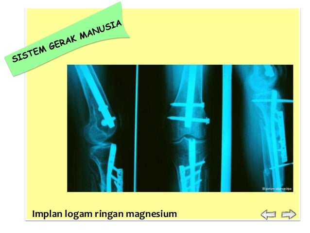 Sistem Gerak 26291117