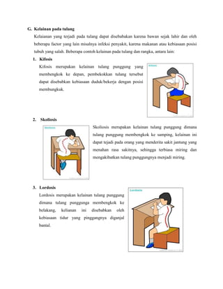 G. Kelainan pada tulang
Kelaianan yang terjadi pada tulang dapat disebabakan karena bawan sejak lahir dan oleh
beberapa factor yang lain misalnya infeksi penyakit, karena makanan atau kebiasaan posisi
tubuh yang salah. Beberapa contoh kelainan pada tulang dan rangka, antara lain:
1. Kifosis
Kifosis merupakan kelainan tulang punggung yang
membengkok ke depan, pembekokkan tulang tersebut
dapat disebabkan kebiasaan duduk/bekerja dengan posisi
membungkuk.

2. Skoliosis
Skoliosis merupakan kelainan tulang punggung dimana
tulang punggung membengkok ke samping, kelainan ini
dapat tejadi pada orang yang menderita sakit jantung yang
menahan rasa sakitnya, sehingga terbiasa miring dan
mengakibatkan tulang punggungnya menjadi miring.

3. Lordosis
Lordosis merupakan kelainan tulang punggung
dimana tulang punggunga membengkok ke
belakang,

kelianan

ini

disebabkan

oleh

kebiasaan tidur yang pinggangnya diganjal
bantal.

 
