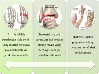 Artritis adalah
peradangan pada sendi,
yang disertai bengkak,
kaku, keterbatasan
gerak, dan rasa sakit
Osteoartritis adalah
kerusakan dan keausan
tulang rawan yang
berfungsi sebagai
bantalan pada sendi
Dislokasi adalah
pergeseran tulang
penyusun sendi dari
posisi semula
 