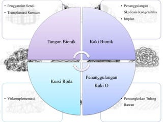 • Pencangkokan Tulang
Rawan
• Viskosuplementasi
• Penanggulangan
Skoliosis Kongenitalis
• Implan
• Penggantian Sendi
• Transplantasi Sumsum
Tangan Bionik Kaki Bionik
Penanggulangan
Kaki O
Kursi Roda
 