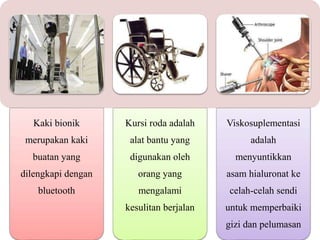 Kaki bionik
merupakan kaki
buatan yang
dilengkapi dengan
bluetooth
Kursi roda adalah
alat bantu yang
digunakan oleh
orang yang
mengalami
kesulitan berjalan
Viskosuplementasi
adalah
menyuntikkan
asam hialuronat ke
celah-celah sendi
untuk memperbaiki
gizi dan pelumasan
 