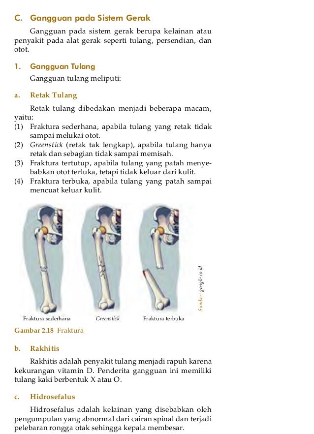 Sistem Gerak Kelas Viii Diana2009