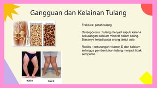 Orang Rakitis SISTEM GERAK PADA MAKHLUK HIDUP.pptx Kelas VIII | PPTX