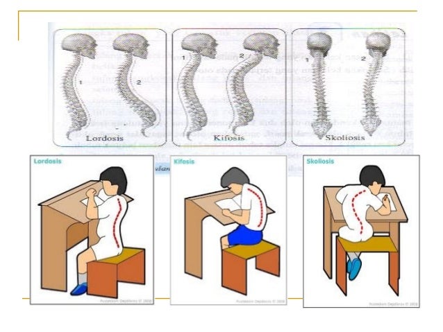 Unduh 660 Gambar Gangguan Pada Otot Manusia Paling Baru Gratis