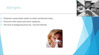 Allergies
 Histamine causes blood vessels to widen and become leaky.
 Fluid and white blood cells leave capillaries.
 The area of leakage becomes hot, red and inflamed
 