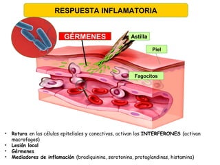 Astilla
Piel
Fagocitos
RESPUESTA INFLAMATORIA
GÉRMENES
• Rotura en las células epiteliales y conectivas, activan los INTERFERONES (activan
macrofagos)
• Lesión local
• Gérmenes
• Mediadores de inflamación (bradiquinina, serotonina, protaglandinas, histamina)
 