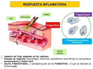 Astilla
Piel
Fagocitos
Capilar
dilatado
Gérmenes
2. Respuesta inmunitaria
inespecífica
Fagocitosis
RESPUESTA INFLAMATORIA
• Aumento del flujo sanguíneo en los capilares
• Difusión de fagocitos (macrófagos, monocitos, eosinófilos y neutrófilos), lo cual produce
enrojecimiento y fiebre local.
• Ocurre FAGOCITOSIS, y autodestrucción de los FAGOCITOS, el cual es liberado en
forma de pus.
 