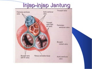 Injap-injap JantungInjap-injap Jantung
 