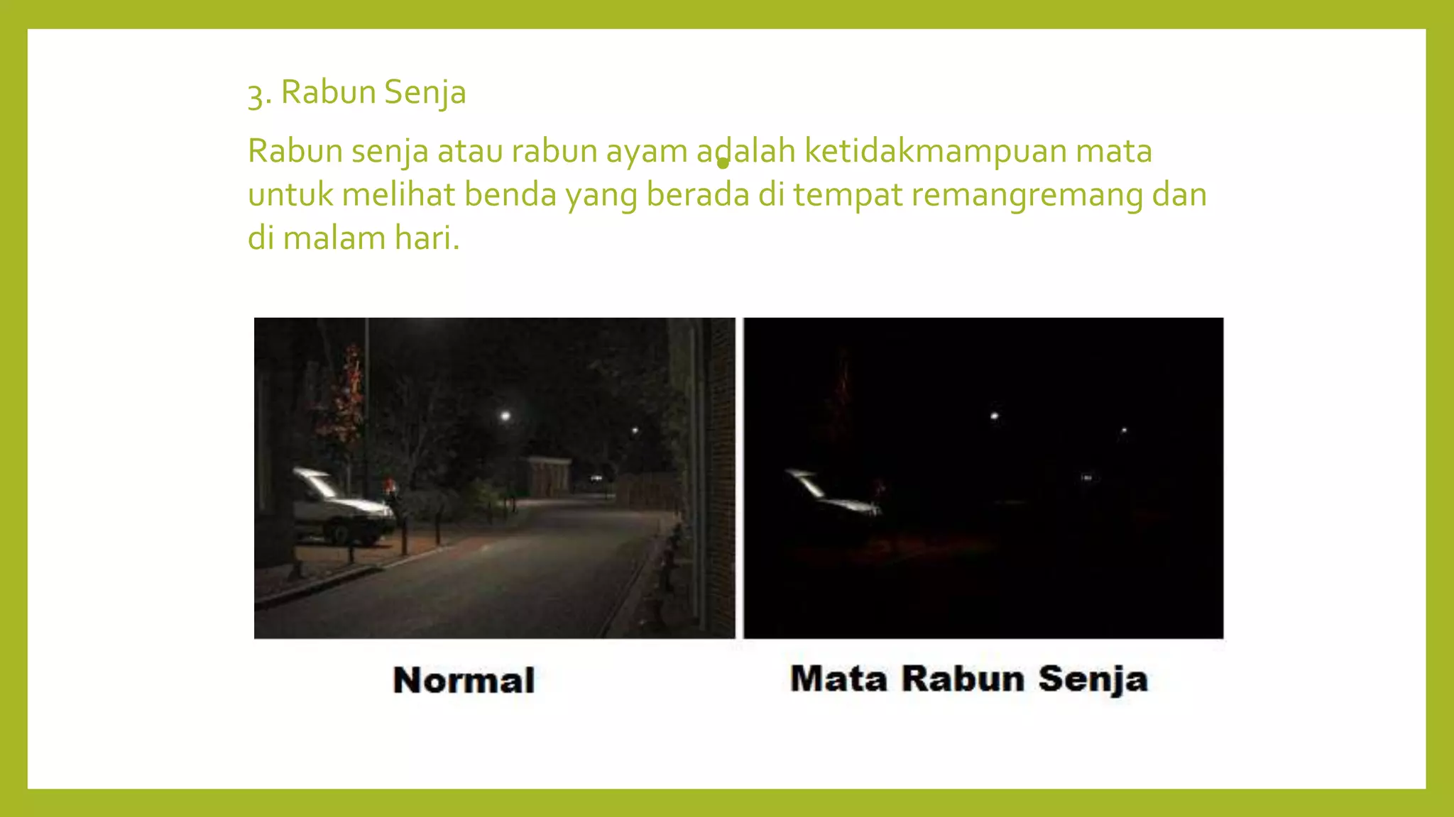 •
3. Rabun Senja
Rabun senja atau rabun ayam adalah ketidakmampuan mata
untuk melihat benda yang berada di tempat remangremang dan
di malam hari.
 