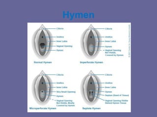 Hymen In Female Comprehensive Overview of Human Male and Female Reproductive Organs and ...