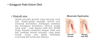 • Gangguan Pada Sistem Otot
• Distrofi otot
adalah penyakit genetik yang merusak serat
otot. Gejala-gejala penyakit distrofi otot
termasuk kelemahan, kehilangan mobilitas
dan kurangnya koordinasi. Distrofi terjadi
sejak anak – anak dimana lebih dari 50.000
orang Amerika menderita dengan salah satu
dari sembilan bentuk penyakit, yang dapat
terjadi setiap saat dalam kehidupan
seseorang dan belum ada obatnya.
 