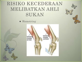 RISIKO KECEDERAAN
 MELIBATKAN AHLI
      SUKAN
      Hamstring
 