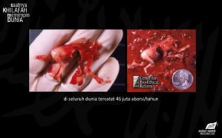 di seluruh dunia tercatat 46 juta aborsi/tahun
 