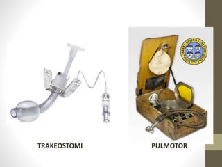 TRAKEOSTOMI PULMOTOR
 
