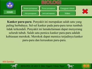 Kanker paru-paru. Penyakit ini merupakan salah satu yang
paling berbahaya. Sel-sel kanker pada paru-paru terus tumbuh
tidak terkendali. Penyakit ini lamakelamaan dapat menyerang
seluruh tubuh. Salah satu pemicu kanker paru-paru adalah
kebiasaan merokok. Merokok dapat memicu terjadinya kanker
paru-paru dan kerusakan paru-paru.
Sistem pernapasan
Alat pernapasan
Proses pernapasan
Jenis pernapasan
Gangguan sistem
Video
BIOLOGI, XI MIA 3, SMA Negeri 2 Kota Tegal
Klik Gambar
HOME
 