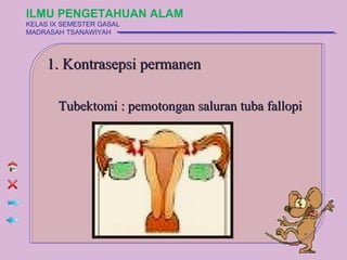 ILMU PENGETAHUAN ALAM
KELAS IX SEMESTER GASAL
MADRASAH TSANAWIYAH




     1. Kontrasepsi permanen

       Tubektomi : pemotongan saluran tuba fallopi
 