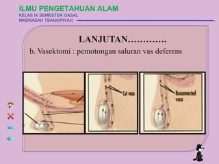 ILMU PENGETAHUAN ALAM
KELAS IX SEMESTER GASAL
MADRASAH TSANAWIYAH



                          մ…Ħ…….
    b. Vasektomi : pemotongan saluran vas deferens
 