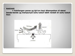 • RADIASI
 Kehilangan panas yg tjd krn bayi ditempatkan di dekat
benda-benda yg mempunyai suhu tubuh lebih rendah dr suhu tubuh
bayi.
 