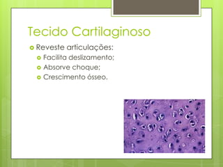 Tecido Cartilaginoso
 Reveste




articulações:

Facilita deslizamento;
Absorve choque;
Crescimento ósseo.

 