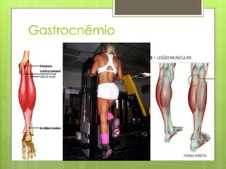 Gastrocnêmio

 