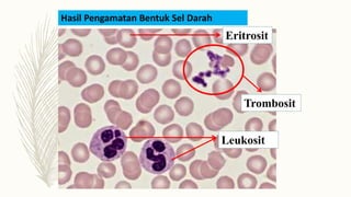 Hasil Pengamatan Bentuk Sel Darah
Trombosit
Leukosit
Eritrosit
 