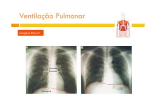 Ventilação Pulmonar
Imagens Raio-X
 