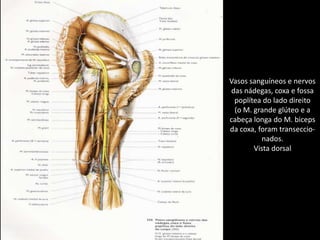 Vasos sanguíneos e nervosdas nádegas, coxa e fossapoplítea do lado direito(o M. grande glúteo e acabeça longa do M. bicepsda coxa, foram transeccio-nados.Vista dorsal