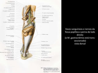 Vasos sanguíneos e nervos dafossa poplítea e perna do ladodireito(o M. gastrocnêmio está trans-seccionado)vista dorsal