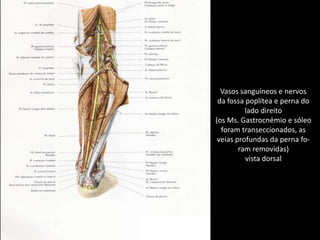 Vasos sanguíneos e nervosda fossa poplítea e perna dolado direito(os Ms. Gastrocnémio e sóleoforam transeccionados, as veias profundas da perna fo-ram removidas)vista dorsal