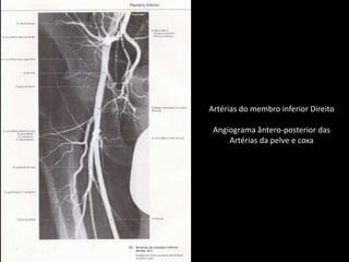 Artérias do membro inferior DireitoAngiogramaântero-posterior dasArtérias da pelve e coxa