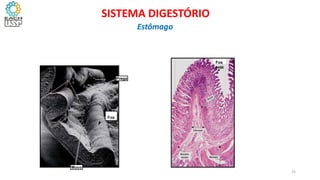 Fos
seta
Fos
seta
s
Prega
Muco
25
SISTEMA DIGESTÓRIO
Estômago
 