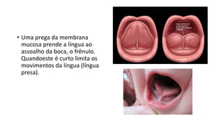 • Uma prega da membrana
mucosa prende a língua ao
assoalho da boca, o frênulo.
Quandoeste é curto limita os
movimentos da língua (língua
presa).
 