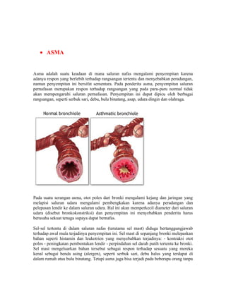 • ASMA


Asma adalah suatu keadaan di mana saluran nafas mengalami penyempitan karena
adanya respon yang berlebih terhadap rangsangan tertentu dan menyebabkan peradangan,
namun penyempitan ini bersifat sementara. Pada penderita asma, penyempitan saluran
pernafasan merupakan respon terhadap rangsangan yang pada paru-paru normal tidak
akan mempengaruhi saluran pernafasan. Penyempitan ini dapat dipicu oleh berbagai
rangsangan, seperti serbuk sari, debu, bulu binatang, asap, udara dingin dan olahraga.




Pada suatu serangan asma, otot polos dari bronki mengalami kejang dan jaringan yang
melapisi saluran udara mengalami pembengkakan karena adanya peradangan dan
pelepasan lendir ke dalam saluran udara. Hal ini akan memperkecil diameter dari saluran
udara (disebut bronkokonstriksi) dan penyempitan ini menyebabkan penderita harus
berusaha sekuat tenaga supaya dapat bernafas.

Sel-sel tertentu di dalam saluran nafas (terutama sel mast) diduga bertanggungjawab
terhadap awal mula terjadinya penyempitan ini. Sel mast di sepanjang bronki melepaskan
bahan seperti histamin dan leukotrien yang menyebabkan terjadinya: - kontraksi otot
polos - peningkatan pembentukan lendir - perpindahan sel darah putih tertentu ke bronki.
Sel mast mengeluarkan bahan tersebut sebagai respon terhadap sesuatu yang mereka
kenal sebagai benda asing (alergen), seperti serbuk sari, debu halus yang terdapat di
dalam rumah atau bulu binatang. Tetapi asma juga bisa terjadi pada beberapa orang tanpa
 