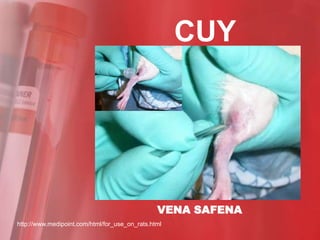 CUY




                                                VENA SAFENA
http://www.medipoint.com/html/for_use_on_rats.html
 