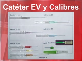 Catéter EV y Calibres
 