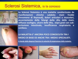 Sclerosi Sistemica, io la conoscoLa Sclerosi Sistemica è una malattia caratterizzata da manifestazioni cliniche subdole; mani fredde (Fenomeno di Raynaud), dolori articolari e muscolari, accorciamento delle falangi delle dita delle mani, reflusso esofageo, ulcere delle dita,  stipsi gravi con sub-occlusione intestinale, insufficienza respiratoria e cardiaca.LA MALATTIA E’ ANCORA POCO CONOSCIUTA TRA I MEDICI DI BASE ED ANCHE TRA I MEDICI SPECIALISTI.Il ritardo della diagnosi favorisce la velocità di progressione della malattia.