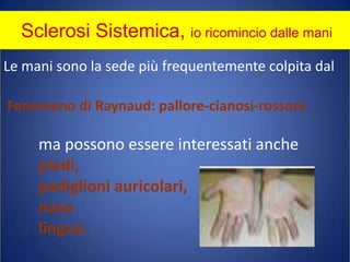 Sclerosi Sistemica, io ricomincio dalle maniLe mani sono la sede più frequentemente colpita dal Fenomeno di Raynaud: pallore-cianosi-rossore	ma possono essere interessati anchepiedi,	padiglioni auricolari,	naso 	lingua.