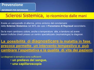 Sclerosi Sistemica, io ricomincio dalle maniEsiste un campanello di allarme, primo sintomo del conclamarsi della Sclerosi Sistemica nel 90% dei casi: il Fenomeno di Raynaudsecondario.Se le mani cambiano colore, anche a temperature  alte, e tendono ad avere lesioni trofiche chiedi presso un centro specializzato (reumatologia) la diagnosi.La  possibilità  di diagnosticarela malattia in fase precoce permette  un intervento tempestivo e  puòcambiare l’aspettativa e la qualità  di vita dei pazienti.La diagnosi è semplice sono sufficienti: un prelievo del sangue,