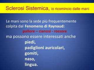 Sclerosi Sistemica, io ricomincio dalle mani	Le mani sono la sede più frequentemente 	colpita dal Fenomeno di Raynaud:pallore – cianosi - rossore 	ma possono essere interessati anchepiedi,	padiglioni auricolari,	gomiti,	naso, 	lingua.